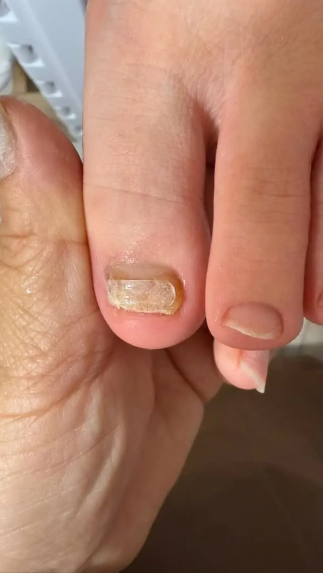 菌バスターはじめて約半年