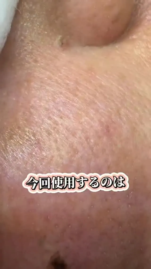 2026年エステ部門始めます！